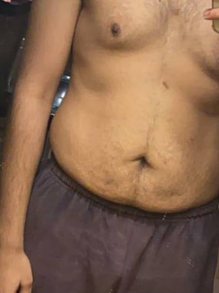 GymFinity online coaching client before losing belly fat